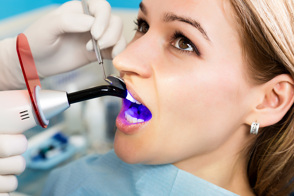 Cavities and Fillings treatment planning