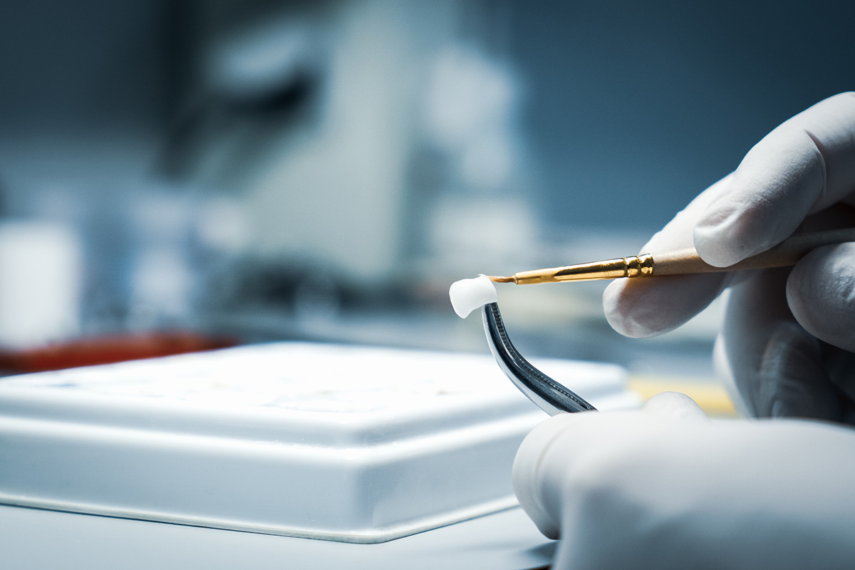 Dental Implants treatment planning