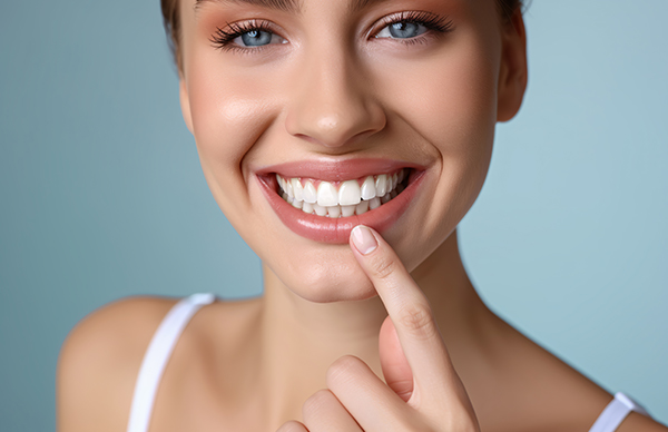 Veneers